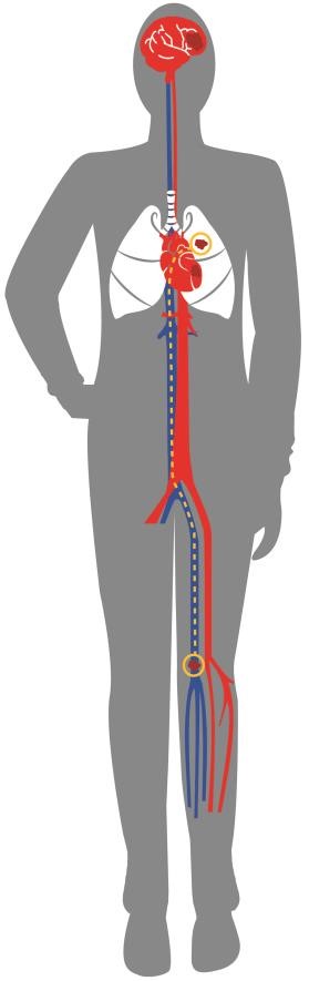 VTE Prophylaxis(圖3)